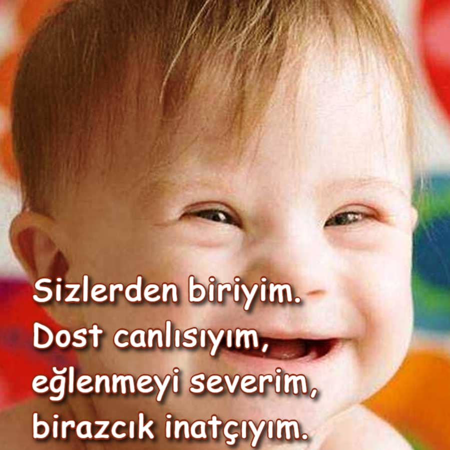En İyi Down Sendromu Durumları