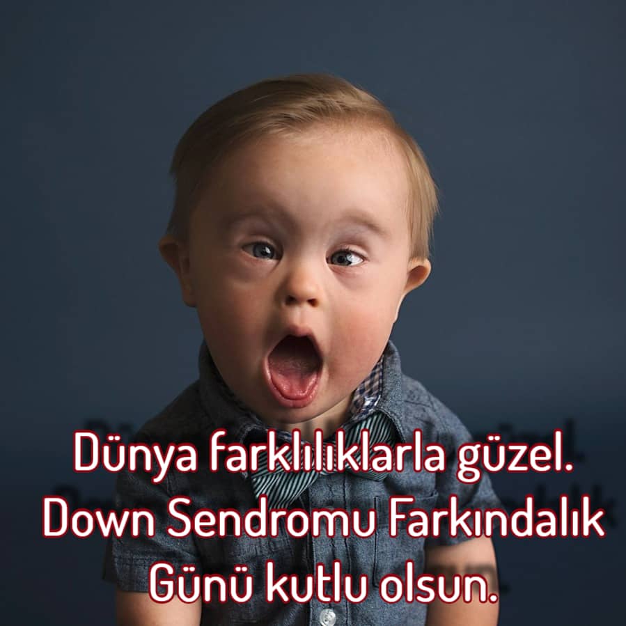 En Özel Down Sendromu Sözleri