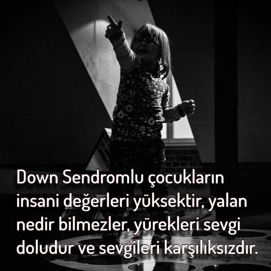 Karşılıksız sevgi Down Sendromu