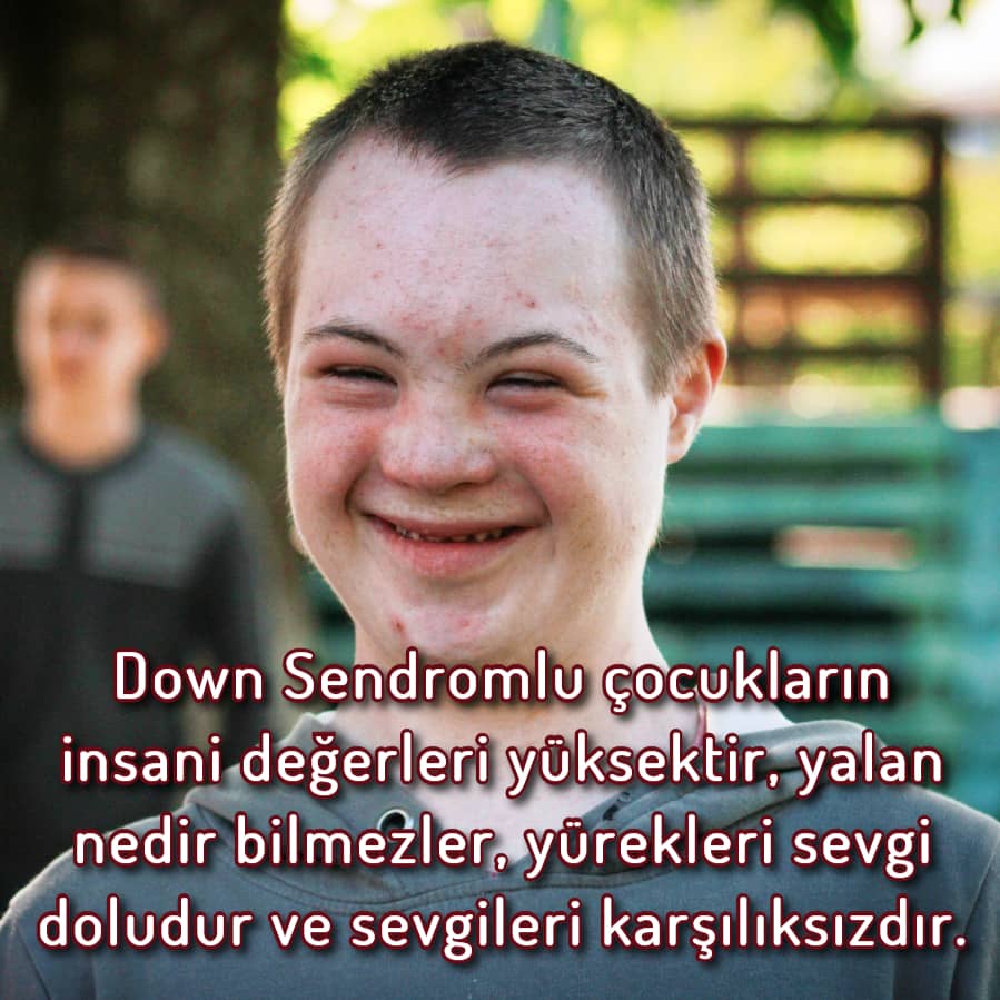 Özel Down Sendromu Günü Sözleri